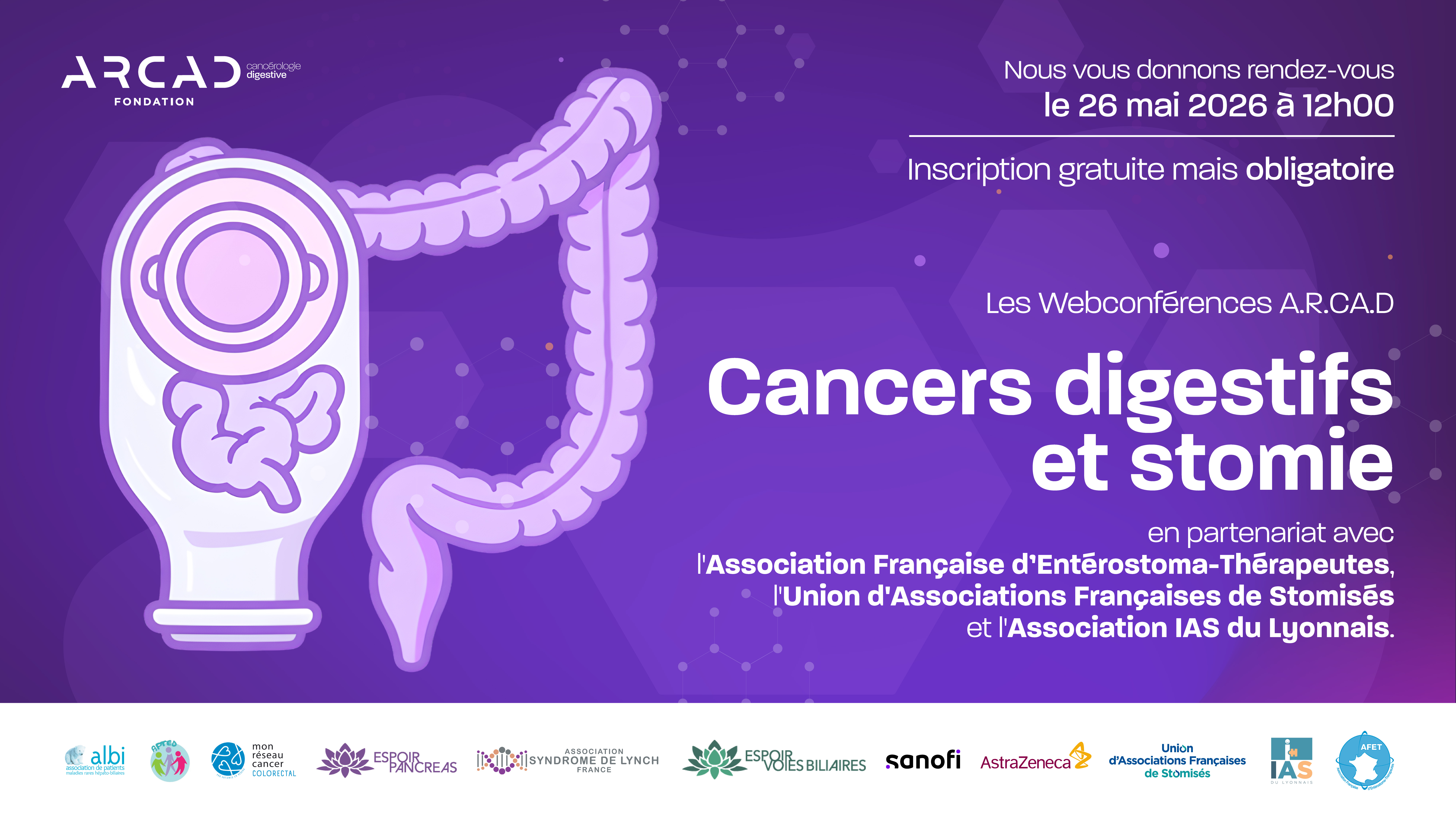 26.05.2026 : Webconférence « Les cancers digestifs et la stomie »